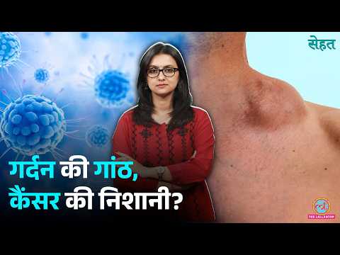 Lymphoma कैसे होता है? इसे पहचानने का तरीका समझ लीजिए | Blood Cancer | Sehat Ep 1454