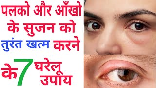 Palko aur ankho ki sujan ko khatm krne ke upay आंखो का सूजन कैसे कम करें how to treat puffy eyes