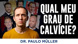 Qual o Seu Grau de Calvície? Aprenda com Exemplos Reais!