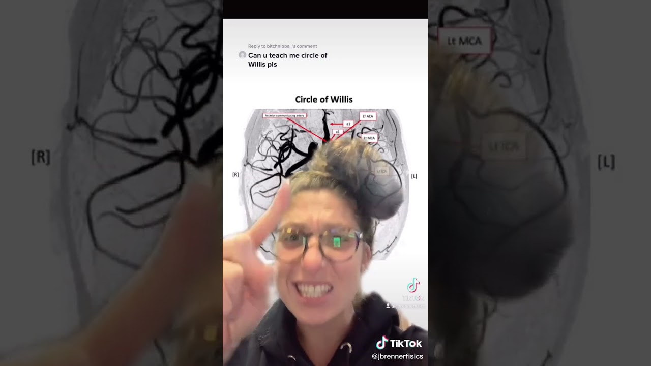 Circle of Willis || Anatomy Made Easy - YouTube