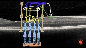 Normal Macular OCT Line Scan
