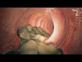 How does your body turns food into the poop? Live