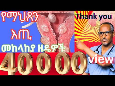 ሞኝ የማህጽን እጢ Thank You More Than 40000 Views In Less Than 2 Moths