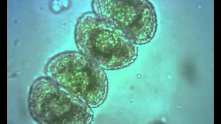 Green Algae. Cosmarium: cytoplasmic streaming?