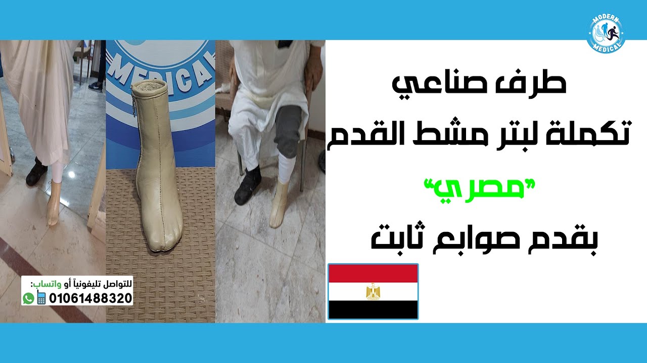 طرف صناعي تكملة لبتر مشط القدم (مصري 🇪🇬) بقدم صوابع مستورد