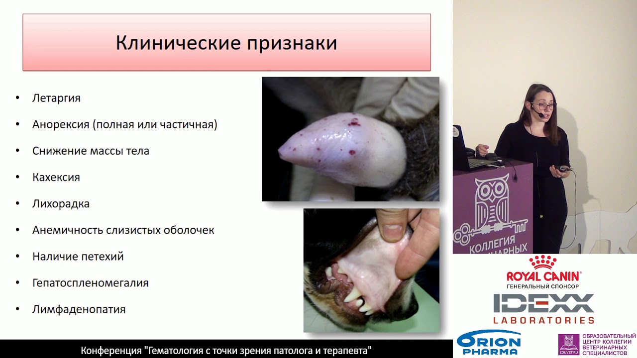 Кузнецова А. Л. - Миелодиспластический синдром в онкологии - мой ...