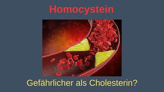 Homocystein - gefährlicher als Cholesterin?