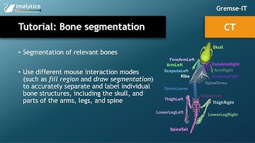 Tutorial video (CT): "Bone segmentation"
