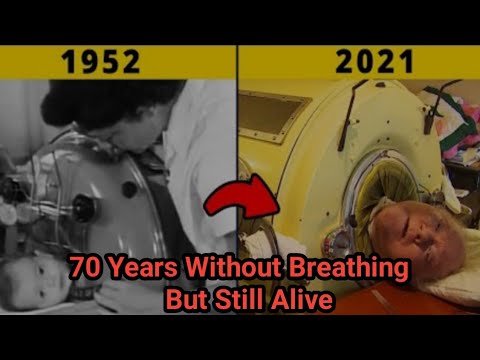 The Man with Iron Lung | Paul Alexander with Iron Lung | #shorts #Inspirationalfacts #ytshorts