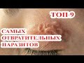 Топ 9 Самых отвратительных и страшных паразитов на планете