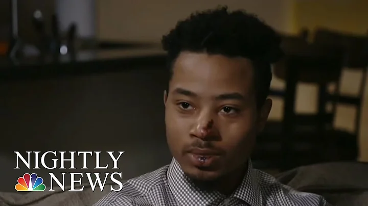 Man Beaten By Georgia Cops Speaks Out (Exclusive) | NBC Nightly News