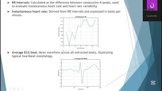 BME-390 | Biomedical Signal Analysis – ECG | Student Presentation 4