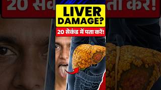 Fatty liver ka reason | cure fatty liver disease | fatty liver ke karan | #viral #trending #reels