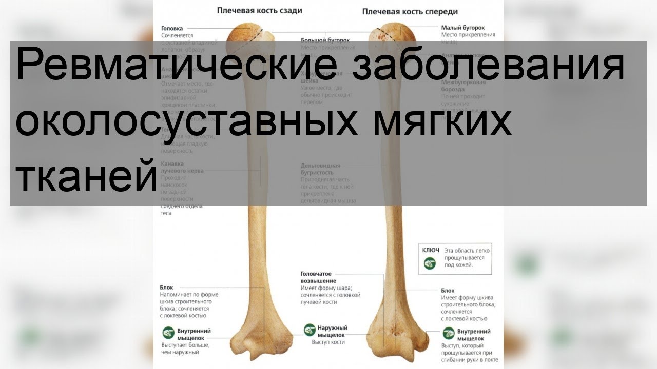 Ревматические заболевания околосуставных мягких тканей