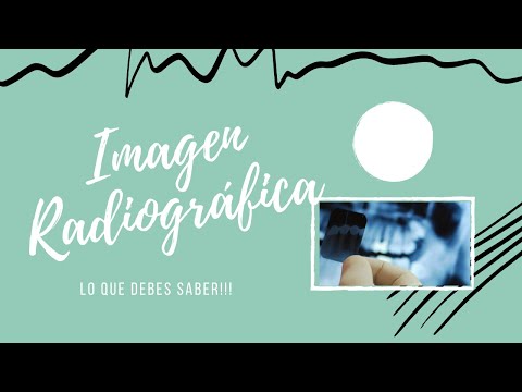 Video: ¿Qué es la radiografía dejada?