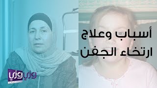 أسباب وعلاج ارتخاء الجفن