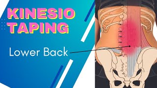 How to treat Lower back pain and sacroiliac joint using Kinesiology taping screenshot 2