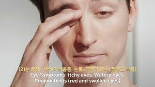 고양이 알레르기: 원인, 증상, 치료 방법 및 확인 방법🤧 Cat Allergy: Causes, Symptoms, Treatment and How to Check🤧