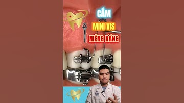 Cắm mini vis niềng răng #nhakhoa #shorts #bacsithao #chinhnha