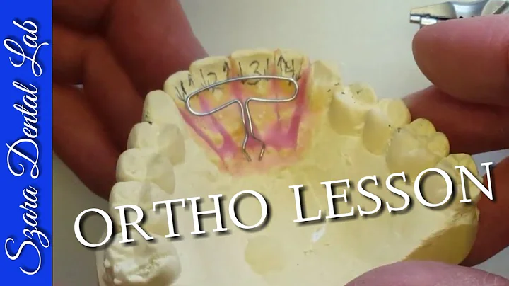 Orthodontic Wire Bending Lesson