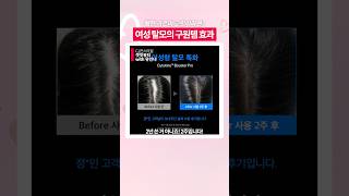 여성 탈모이신 분들 보세요 #유인나 #겟잇뷰티with유인나