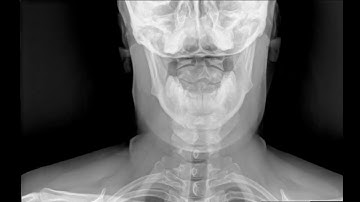 Dynamic Digital Radiography   DDR Imaging