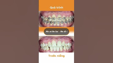 Hành trình LỘT XÁC của Thanh Vân