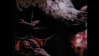 Pyaemia - Cerebral Cereal