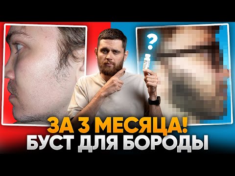 В 29 ЛЕТ НЕ РОСЛА БОРОДА / Результаты средства для роста бороды mr.Volos