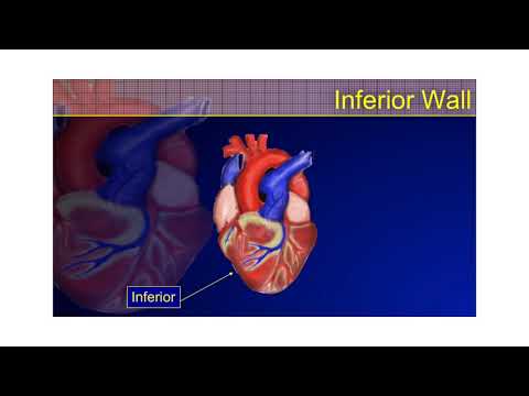 the-12-lead-ecg-course---stemi-part-3