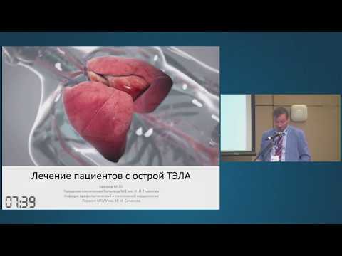 Лечение пациентов с острой ТЭЛА. Гиляров М.Ю.