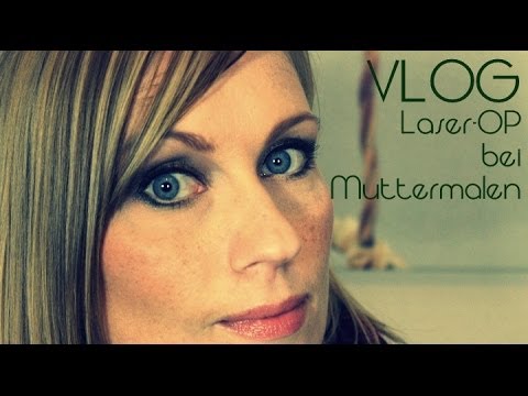 Get Pickelmale Entfernen Laser Pics