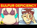 7 signs you have sulfur deficiency