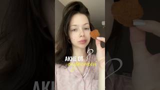 Акне от гадостей 🍿🍩🍔 Так ли это?