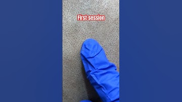 First session of scalp micropigmentation #scalpmicropigmentationindia #scalpmicropigmentation #smp