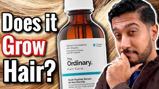 The Ordinary Hair Growth Serum | Is FAST Hair Growth Possible with Serum?