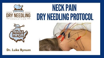 Nekpijn Dry Needling-behandelingsprotocol