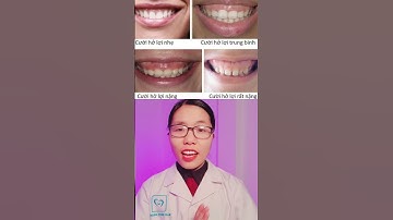 Cách khắc phục tình trạng cười hở lợi