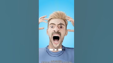 What To Do If You