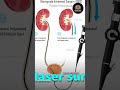 Ureter Stone का सफल इलाज I सर्जरी के बाद का Patient Experience I Dr Ankit Gupta