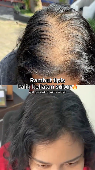 klik link di bio yaa! aku spill produknya #fyp #haircare