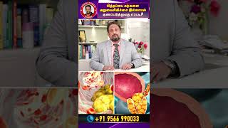 பித்தப்பை கற்கள் நீங்க சிறந்த சிகிச்சை முறை  | Gallbladder Stones Removal short ayush