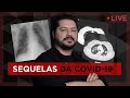 Live 02/10 - As sequelas da COVID