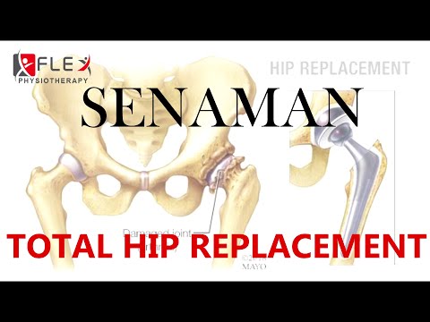 [FLEX PHYSIOTHERAPY] SENAMAN SELEPAS PEMBEDAHAN TULANG PAHA