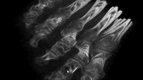 MRI Voxel Real-Time Rendering