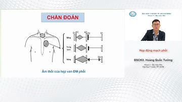 Hẹp động mạch phổi trẻ em BS.CKII Hoàng Quốc Tưởng - Đại học Y Dược TPHCM YDS