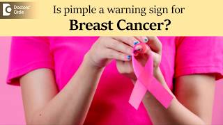 Pimple on breast. | Is it a warning sign for breast cancer? - Dr. Nanda Rajaneesh | Doctors' Circle