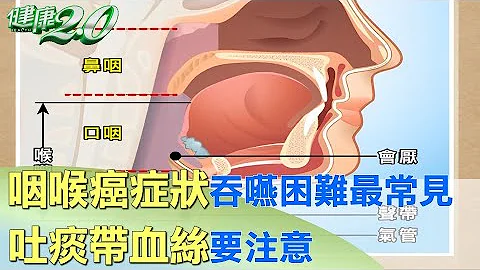 咽喉癌症状吞咽困难最常见 吐痰带血丝要注意 健康2.0 - 天天要闻