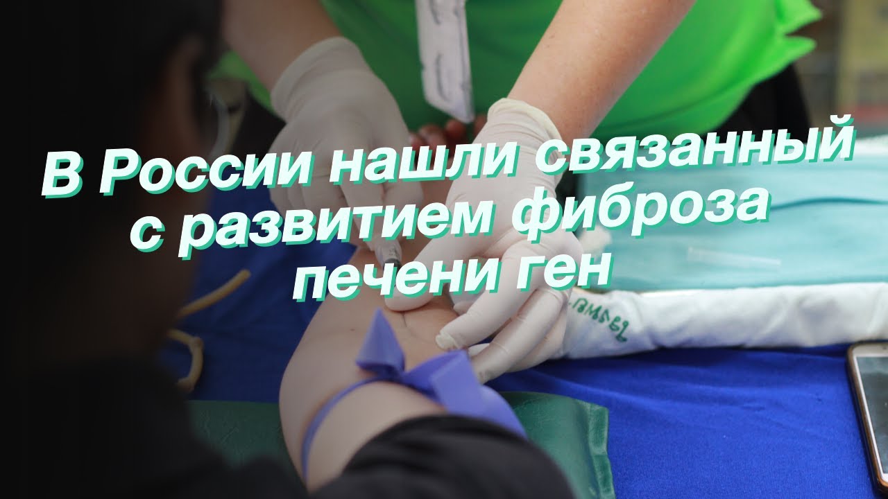 В России нашли связанный с развитием фиброза печени ген