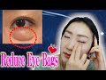 🌛10min Magic Massage to Reduce Under Eye Bags While You Sleep: Insomnia Relief/ Fall Asleep Fast